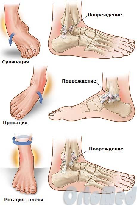 Связки голеностопного сустава схема Связки голеностопного сустава схема