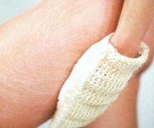 Uyluk ve diğer vücut parçaları üzerinde streç işaretleri kurtulmak için nasıl Uyluk ve diğer vücut parçaları üzerinde streç işaretleri kurtulmak için nasıl