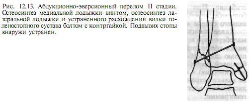 Закрытый перелом наружной лодыжки карта вызова скорой помощи